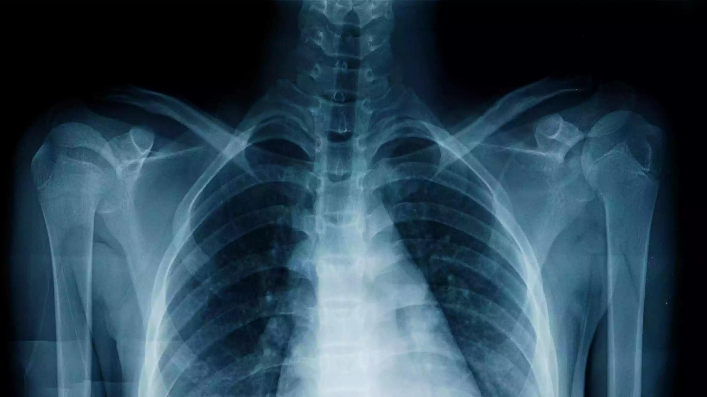 نحوه عملکرد دستگاه ایکس ری X-Ray