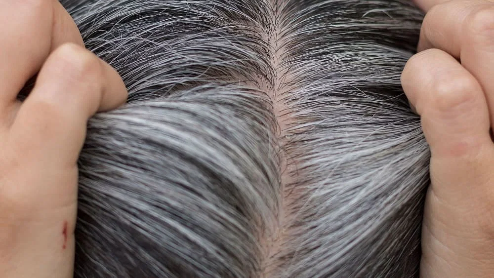 سفیدی مو: علل، پیشگیری و درمان